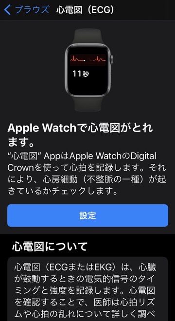 Apple Watchで心電図